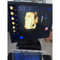 2D 3D 4D Echocardiography Ecografo Ultrasound